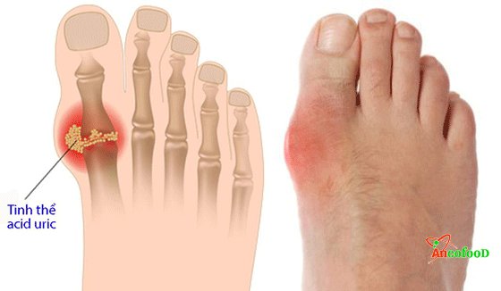 công dụng của râu ngô